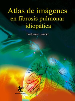 cover image of Atlas de imágenes en fibrosis pulmonar idiopática